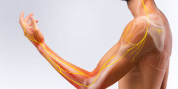 Neuromobilizacje – co to jest i kiedy się stosuje?